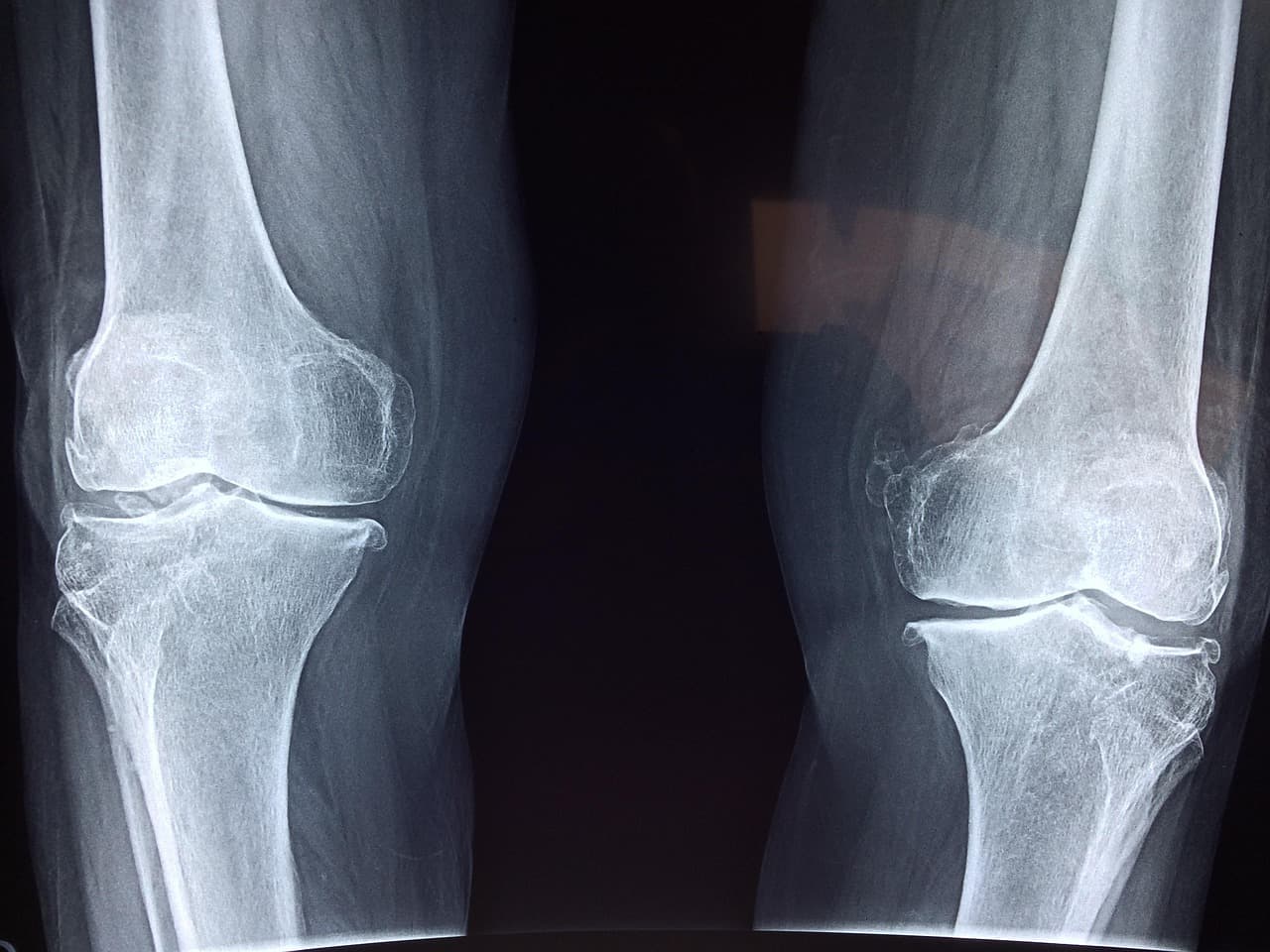 Orthopedics